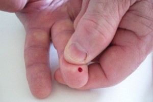 Der Stich in die Fingerbeere für den Blutzuckertest gehört für viele Diabetiker zum Alltag. (Foto: Flickr, AlishaV, Creative Commons-Lizenz)